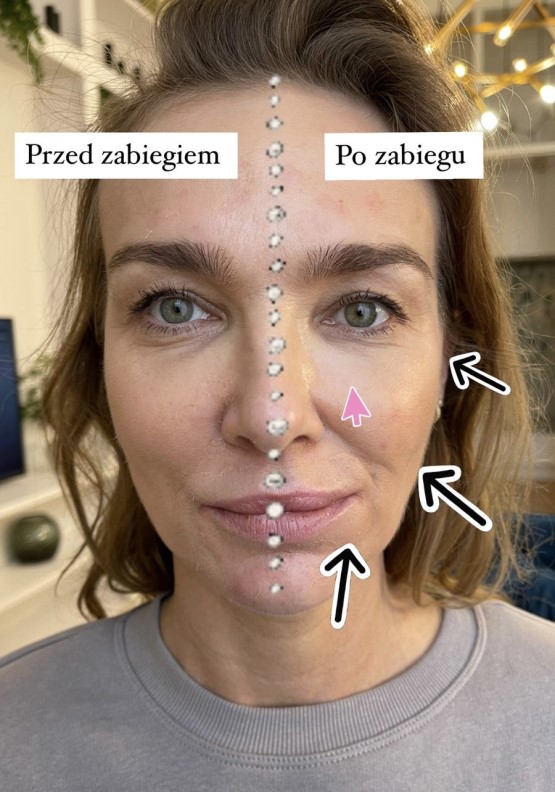 efekt_przed_po
